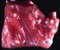 These lesions seen in pork at a slaughterhouse are characteristic of infection with what pathogen? Is it zoonotic?