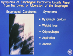Odynophagia is pain with swallowing = probably not surgically resectable because has extended outside esophagus