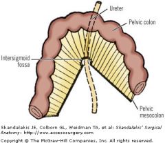 The intersigmoid fossa, a small recess formed by the mesosigmoid, where it attaches to the pelvic sidewall.