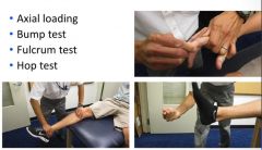 - Axial loading - push proximally on finger / hand
- Bump test - bump heel - feel pain higher up in leg
- Fulcrum test - push down on ankle 
- Hop test - detect stress fracture