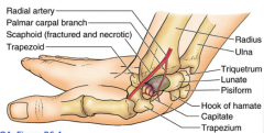 Potentially becoming necrotic - a few branches of radial artery are delivering nutrients to distal half, fracture could cause loss of blood supply to proximal half (leading to necrosis)