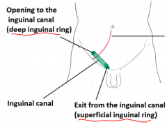 Deep inguinal ring: partial interruption of transversalis fascia
Superficial inguinal ring: triangular interruption in external oblique aponeurosis
-Inguinal canal transmits spermatic cord (M) or round ligament (F)