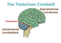 -suptratentoria: Above the tentorium cerebelli (above cerebellum)


-Infratentorial: Subtentorial, below the tentorium cerebelli (Below cerebellum)