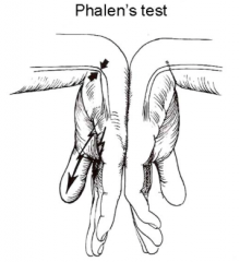 What is being tested here (Phalen's sign)?