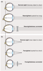 * light is refracted mostly at the anterior surface of the cornea, but also at the anterior and posterior surfaces of the lens
* the retinal image is inverted 
 
 
short-sightedness
 
eyeball is too long and light focuses in front of the retina
 
...