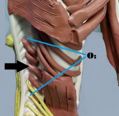 *Stabilize spine during movement 

Origin: C4-L5, Ilium, sacrum I 
Insertion: next high vertebrae  