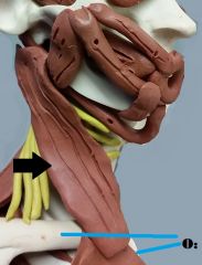 *flexes neck and laterally rotates head away from muscle 

Origin: sternum and clavicle 
Insertion: temporal bone (mastoid process)
