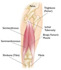 Origin: Ischium (tuberosity)
Insertion: Tibia (proximal end, medial surface)
Function: Extends thigh
Innervation: Hamstring nerve
