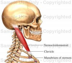 Origin: 1. Sternum 2. Clavicle
Insertion: Temporal bone (mastoid process)
Function: Flexes head (prayer muscle) One muscle alone, rotates head toward opposite side, spasm of this muscle alone or associated with trapezius called torticollis or wr...