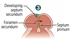 What is the fourth step in septation of the atria, after the septum secundum develops?