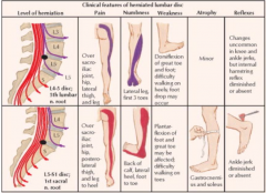 - L4-L5: dorsiflexion of great toe and foot; difficulty walking on heels, foot drop
- L5-S1: plantarflexion of foot and great toe; difficulty walking on toes