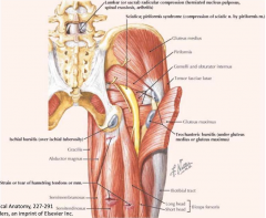 - Lumbar spine (herniated disc)
- Buttocks (bursitis or hamstring injury)
- Pelvic region (intrapelvic disorder)