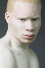 M: Dull White

Ex: Albino