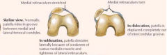 Subluxation of patella / dislocation