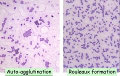 RouleauxAgglutination