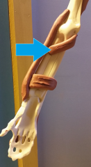 *Pronates forearm (weakly flexes forearm) 

Origin: humerus and ulna (proximal) 
Insertion: radius (proximal) 
