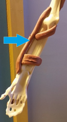 *Flexes forearm (strongest in mid-prone position) 

Origin: humerus 
Insertion: radius (styloid process) 