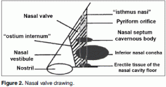 Nasal valve is the narrowest point of nasal airway resistance

Borders: lower edge of upper lateral cartilage, anterior end of inferior turbinates, and nasal septum