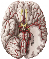 Outline the flow of blood to the brain beginning with the Internal Carotid A.