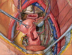 Ureters are retroperitoneal structures. Note close relationship to uterine arteries and veins and parametrium.