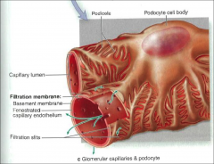 *Note processes of the podocytes (pedicels).