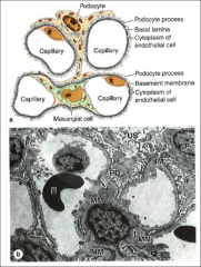 *This is a xs of the glomerular capillaries.
*Podocyte processes are "hairy" looking.
*Mesangial cells are structural cells of the glomerulus.