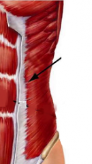 *Compress abdomen and laterally flexes spine 

Origin: 
Insertion: 
