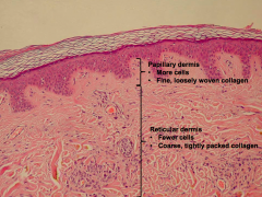 - Papillary - more superficial, more cells, fine / loosely woven collagen, interdigitates w/ rete ridges of epidermis
- Reticular - deeper, fewer cells, coarse / tightly packed collagen