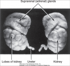 *Kidney at 28 weeks. Note the lobules; they define the locations of renal pyramids.