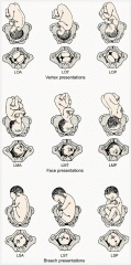 Fetal Position - diagram of different presentations