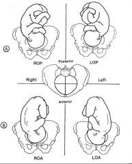 Positions of the fetal head