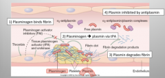 1. Plasminogen binds fibrin in a clot.
2. Plasminogen is activated to plasmin by tissue plasminogen activator.
3. Plasmin degrades fibrin (into fibrin degradation products).
4. Free plasmin is inhibited by antiplasmin.