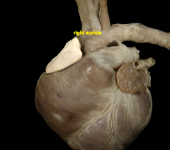 the ear-shaped appendage of either atrium of the heart.
formerly, the atrium of the heart.