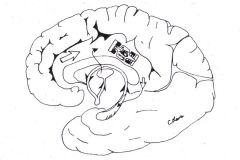 hippocampus => fornix => mammillary bodies => cingulate gyrus => ant. nucleus of the thalamus