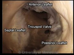 AKA tricuspid valve. Operates the right AV opening. Two major cusps (parietal and septal) in the dog, with intervening secondary cusps.