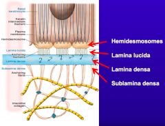 - Hemidesmosomes
- Lamina lucida
- Lamina densa
- Sublamina densa