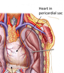 The Pericardium is a fibroserous membrane. The pericardium covers the heart and the great vessel roots