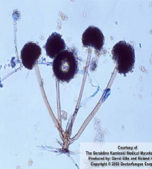 Identify
A.
Rhizomucor spp.


B.Apophysomyces elegans
C.Syncephalastrum
D.Rhisopus spp.