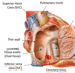The coronary sinus receives all venous return from the heart itself. It drains into the Right Atrium and it's located beside the IVC on the lower rear side.