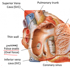 The fossa ovalis is a thin fibrous sheet between the two atria. It is remnant of the foramen ovale which allowed blood to pass from RA --> LA in fetal development