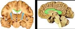 1. corpus collosum (GREEN)- major pathway for axons crossing btwn cerebral hemispheres

2. internal capsule (BLUE)- major pathway btwn cerebral hemispheres & more caudal structures (brainstem, spinal cord, thalmus, etc)