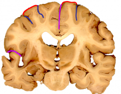 Gyri (RED) and sulci (BLUE) can be seen above.  What are the deeper, more consistent sulci (PURPLE) called?