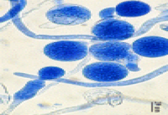 Identify
A.
Rhisopus spp.


B.Conidiobolus
C.Basidiobolus
D.
Apophysomyces elegans


