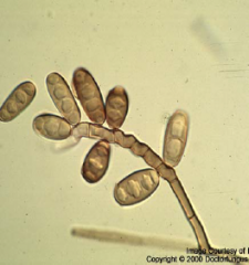 Identify 
A.Scedosporium apiospermum
B.Fonsecaea pedrosoi
C.Bipolaris spp.
D.Exophiala jeanselmei
