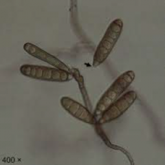Identify
A.Scedosporium apiospermum
B.Phialophora verrucosa
C.Exophiala jeanselmei
D.Exserohilum spp.
