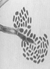Identify
A.
B.Scedosporium apiospermum
C.Exophiala jeanselmei
D.Fonsecaea pedrosoi
