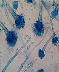 Identify
A.Aspergillus niger
B.Exophiala dermatitidis
C.Aspergillus
D.Acremonium spp