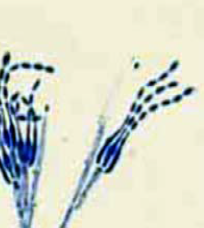 Identify
A.Fusarium spp.
B.Aspergillus terreus
C.aecilomyces spp.
D.Scopulariopsis spp.