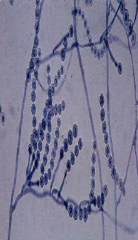 Identify
A.Scopulariopsis spp.
B.aecilomyces spp.
C.Aspergillus terreus
D.Fusarium spp.
