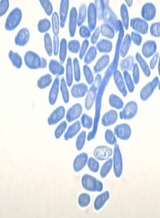 Identify
A.Malassezia
B.Epidermophyton floccosum
C.Trichophyton verrucosum
D.Trichophyton mentagrophytes